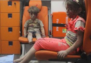 syrian-boy-and-girl-injured